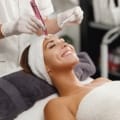 Micro needling full face 1