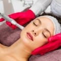 Micro needling including neck 1